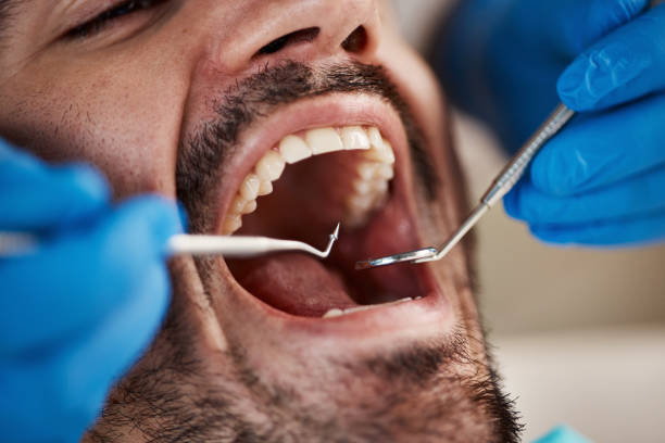 Best Orthodontic Emergency Dentist in Rich Hill, MO