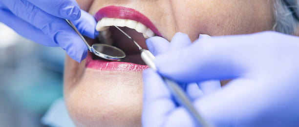 Best Emergency Dental Services for Seniors in Rich Hill, MO