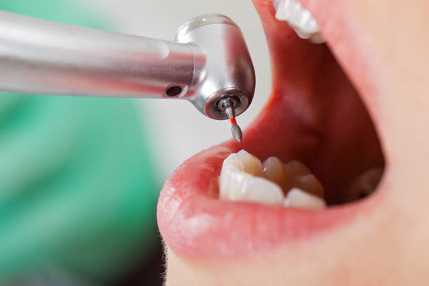 Best Mobile Emergency Dentist in Rich Hill, MO